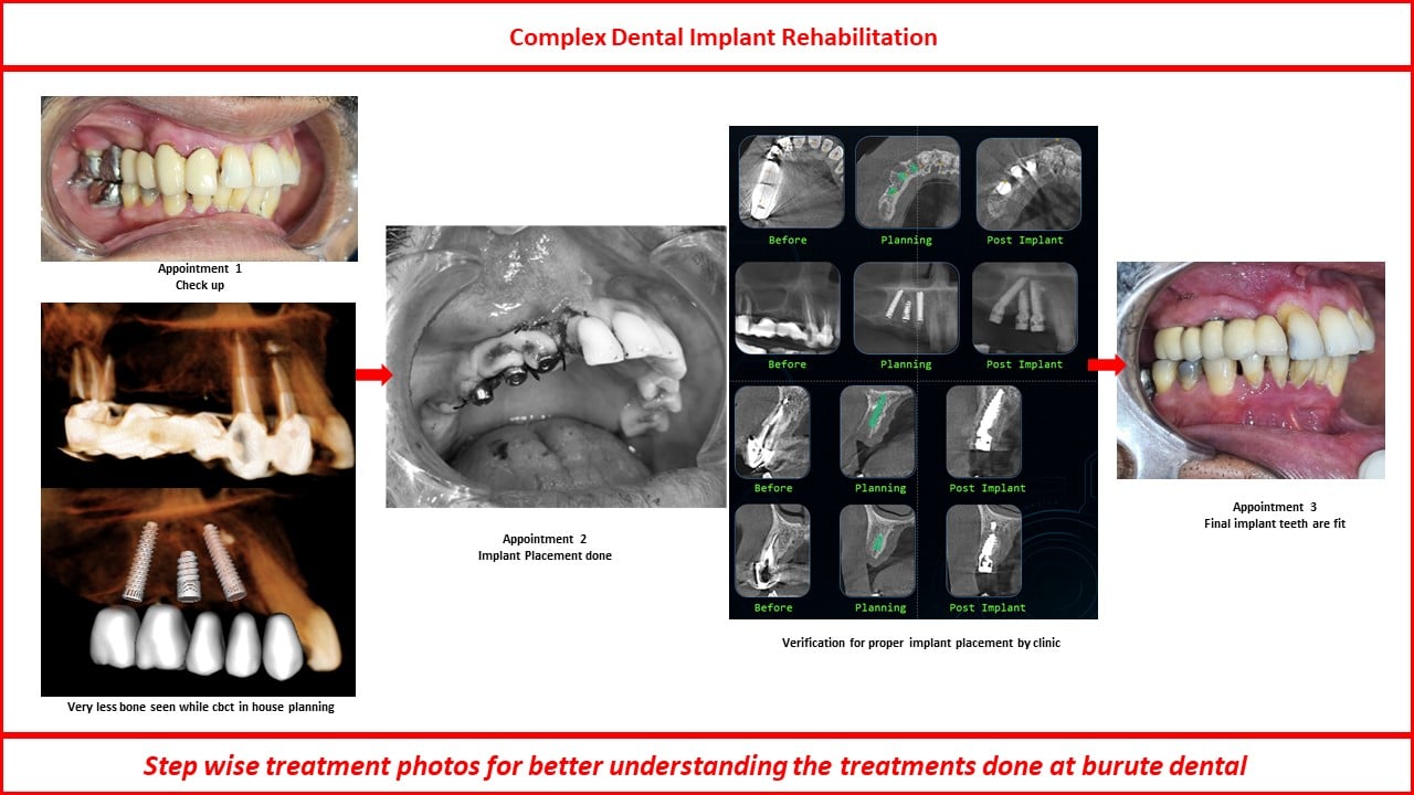 Slide11