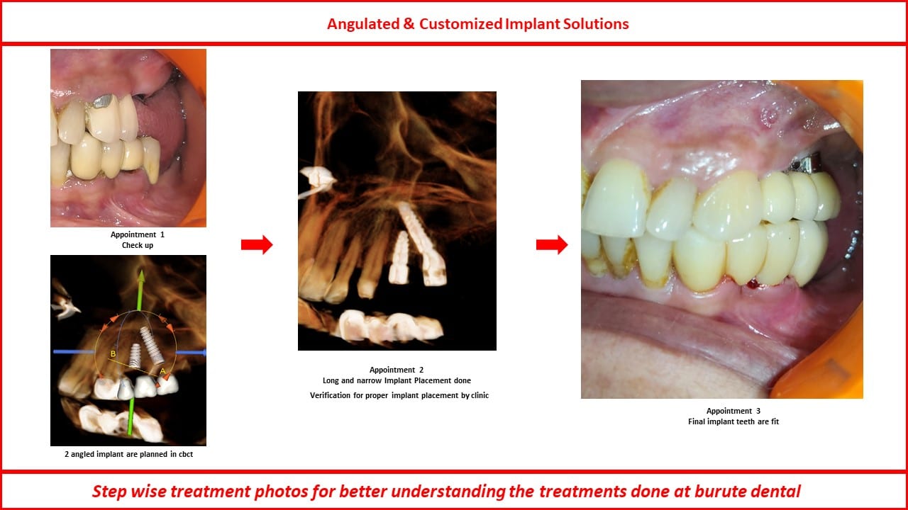 Slide14