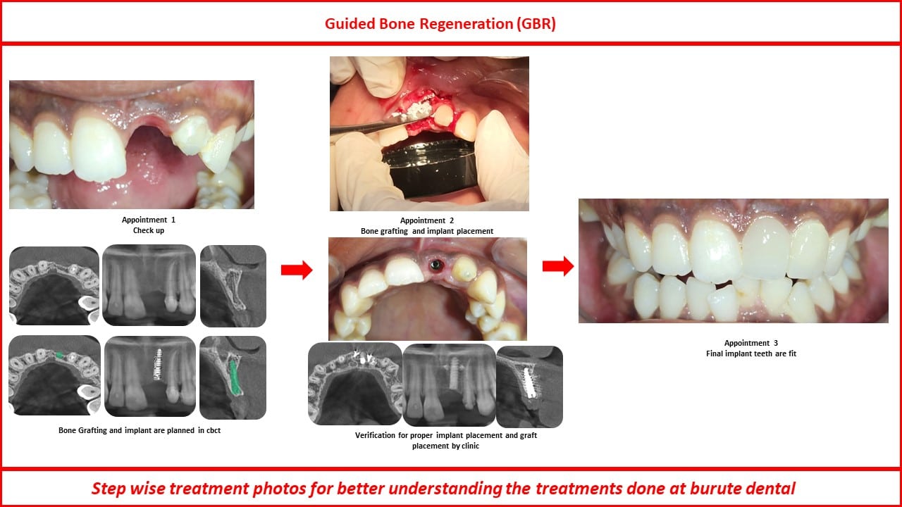 Slide15