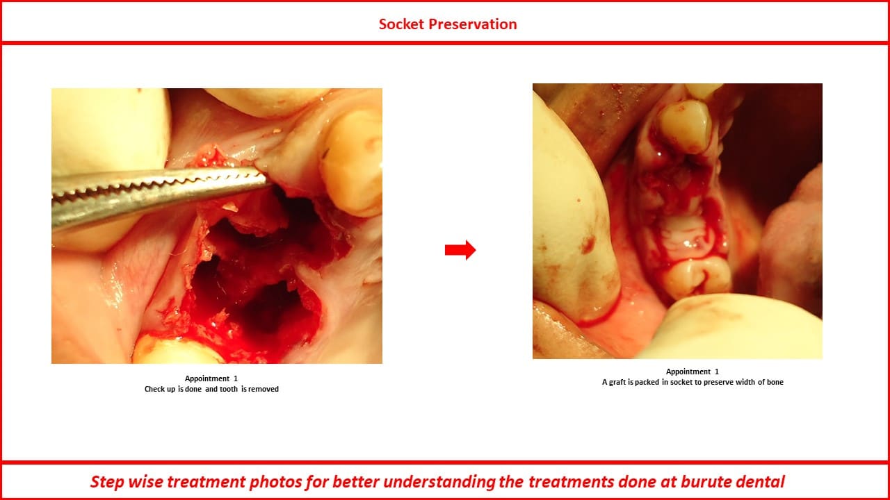 Slide16