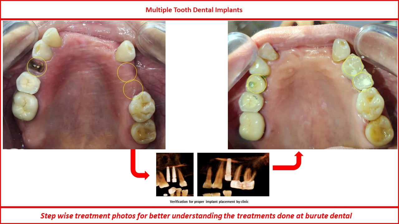 Slide2