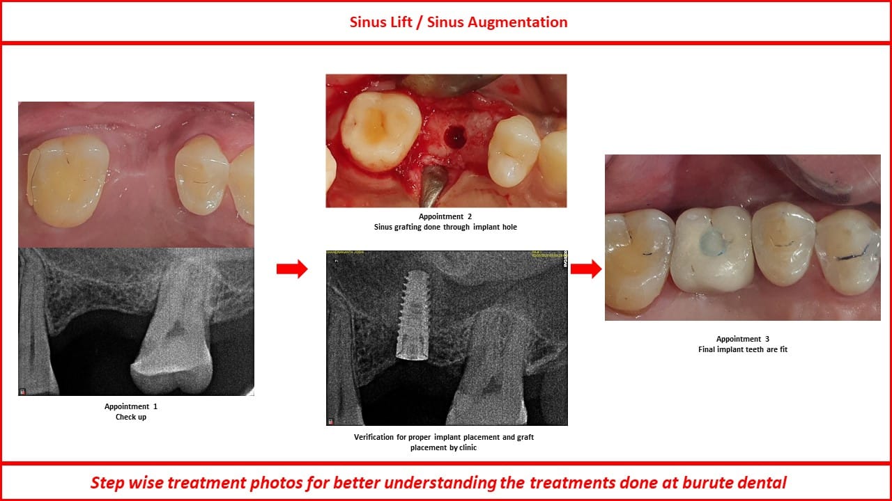 Slide21