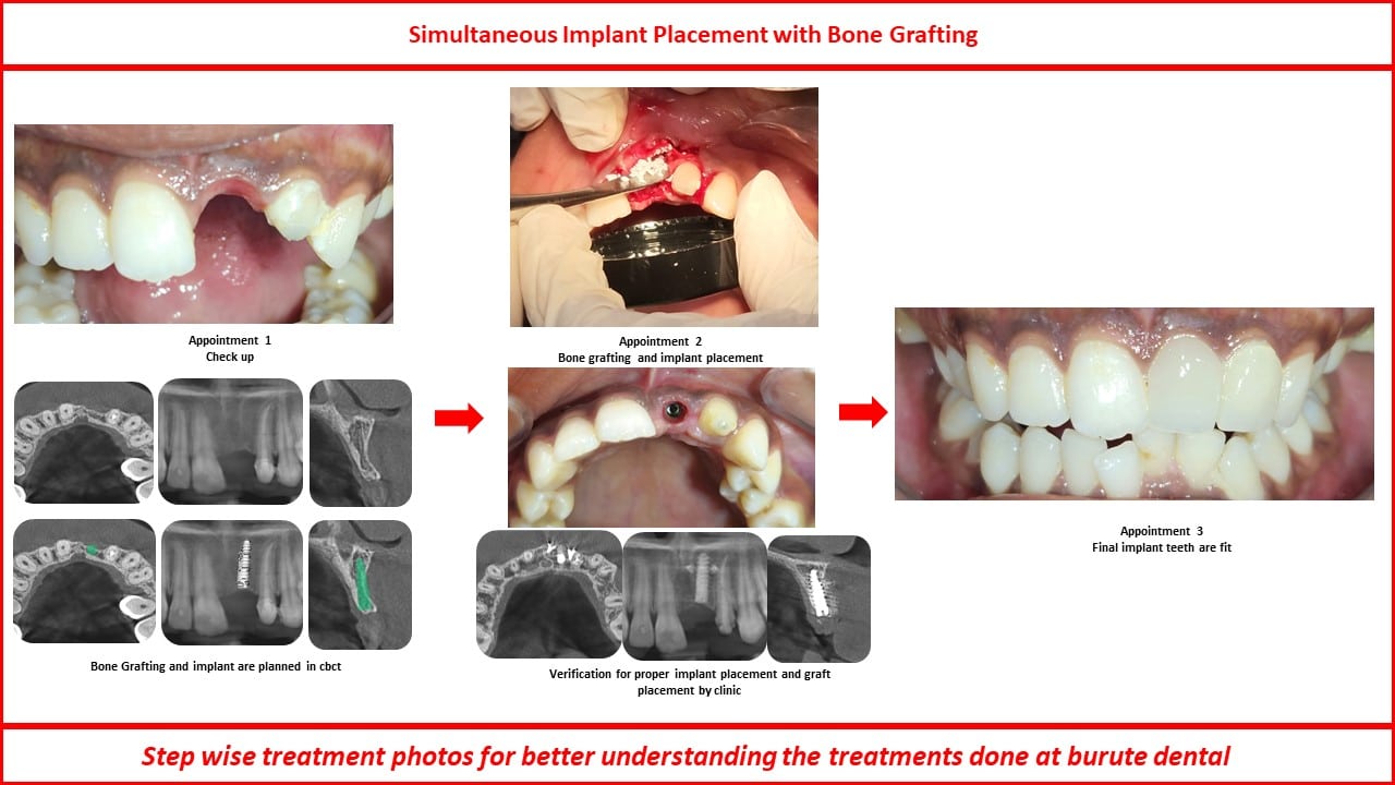 Slide22