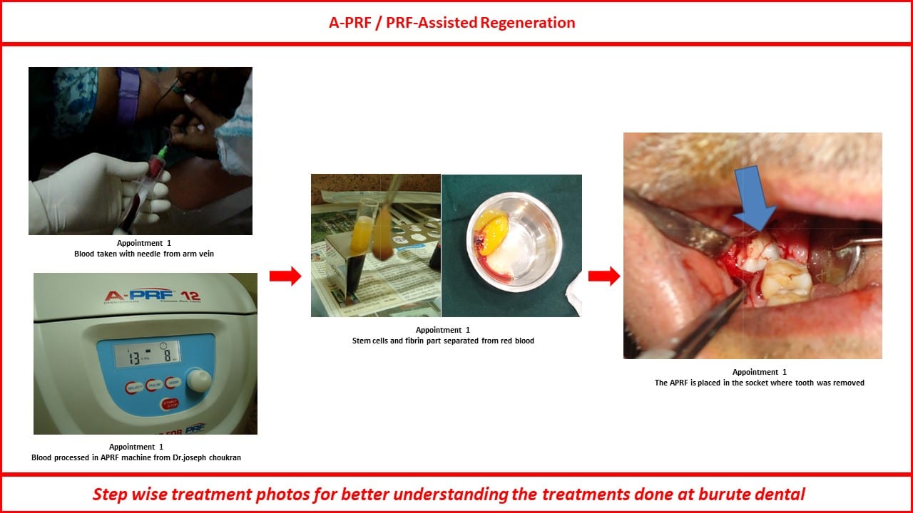 Slide24