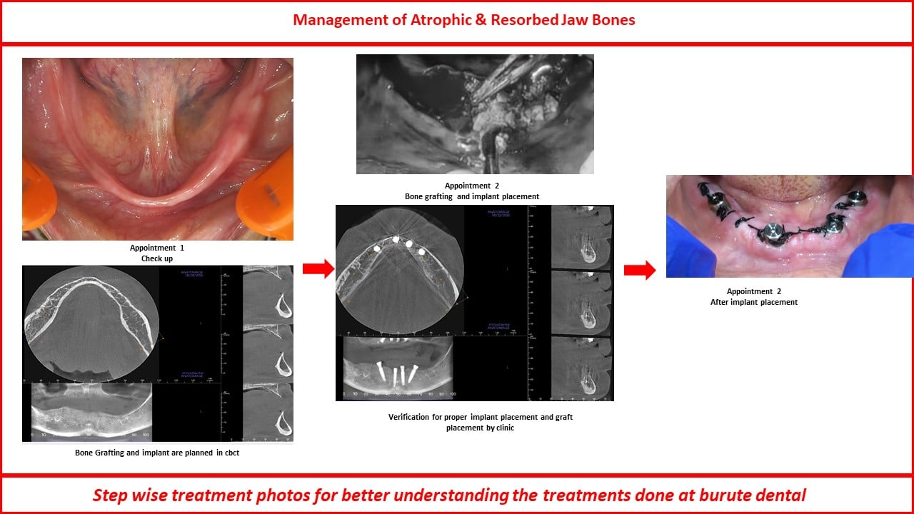 Slide25