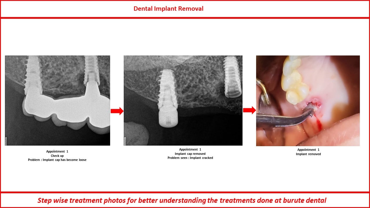 Slide27