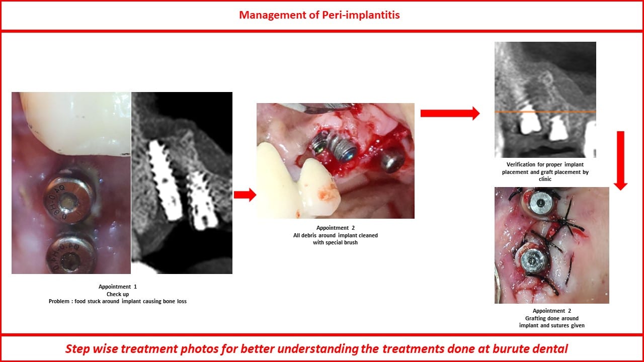 Slide28