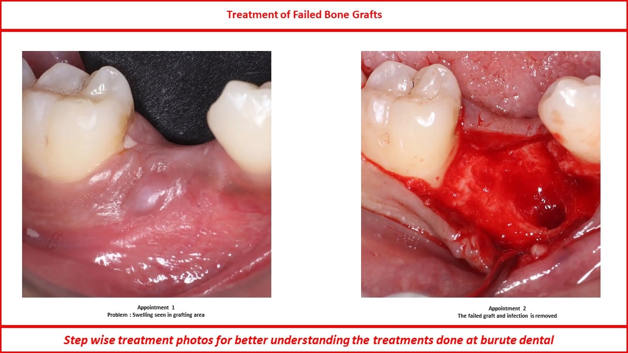 Slide29