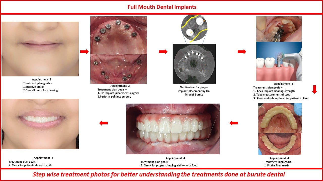 Slide3