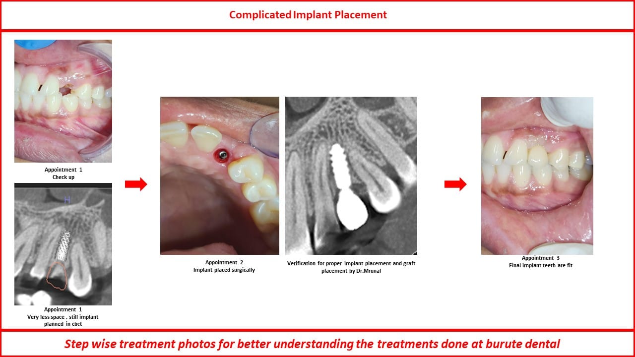 Slide31