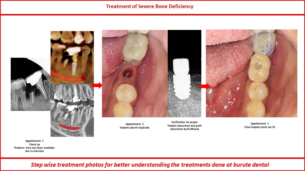 Slide32