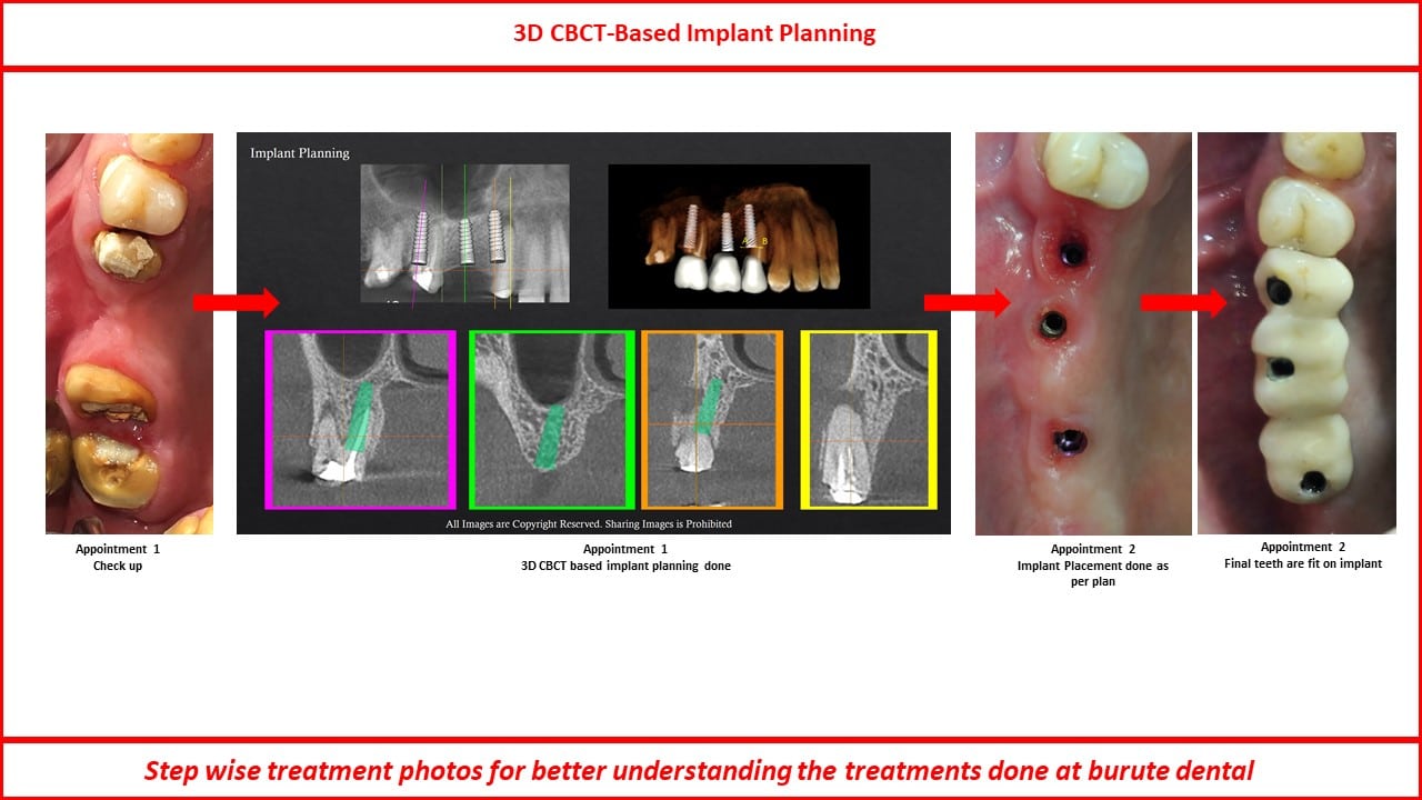 Slide35