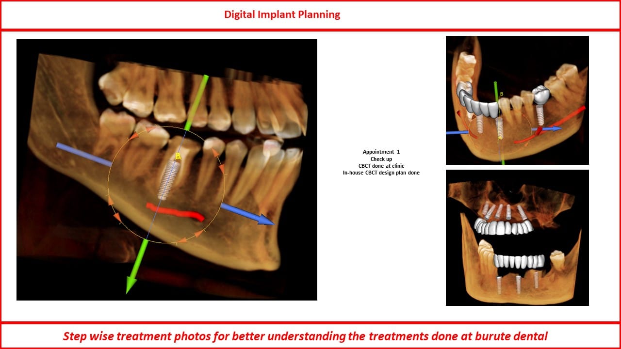 Slide36