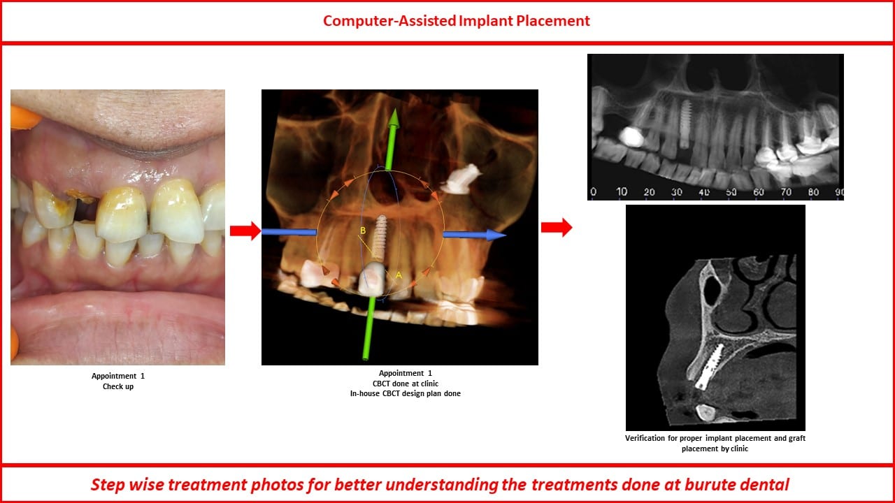 Slide38