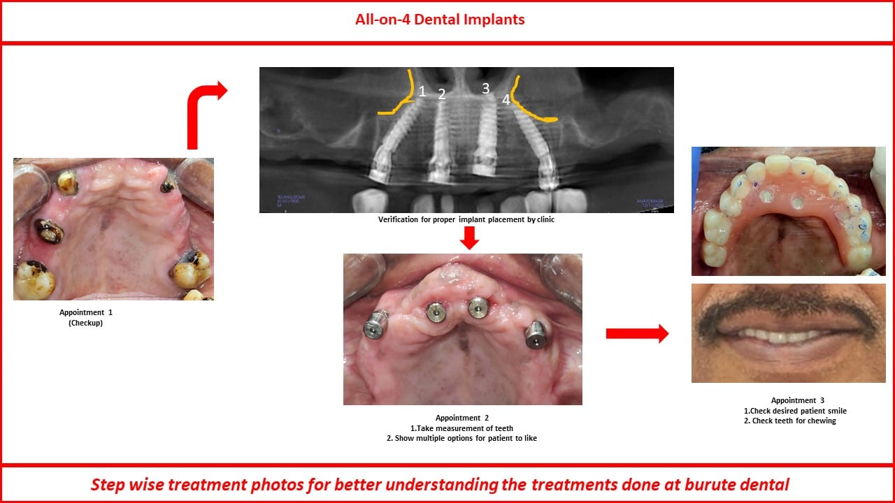 Slide4