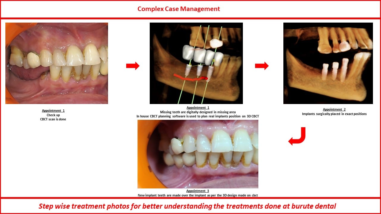 Slide41
