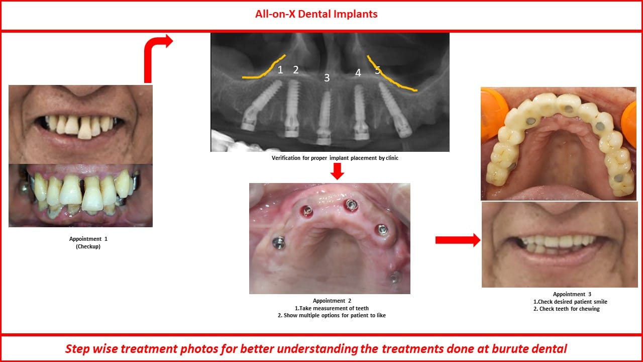 Slide5