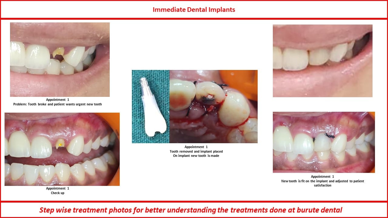 Slide7