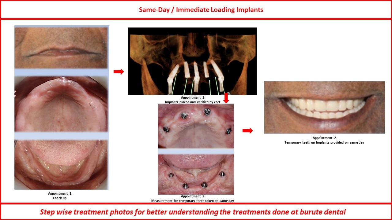 Slide8