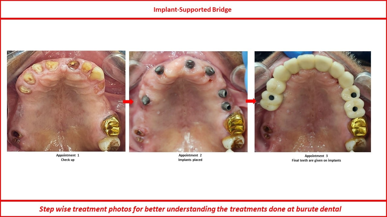 Slide9