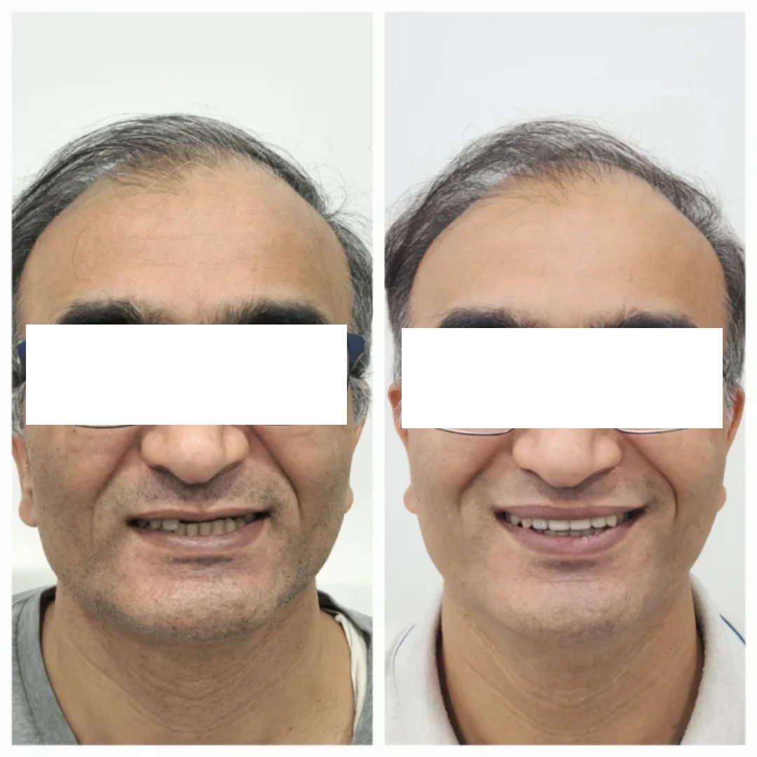 before after case 1