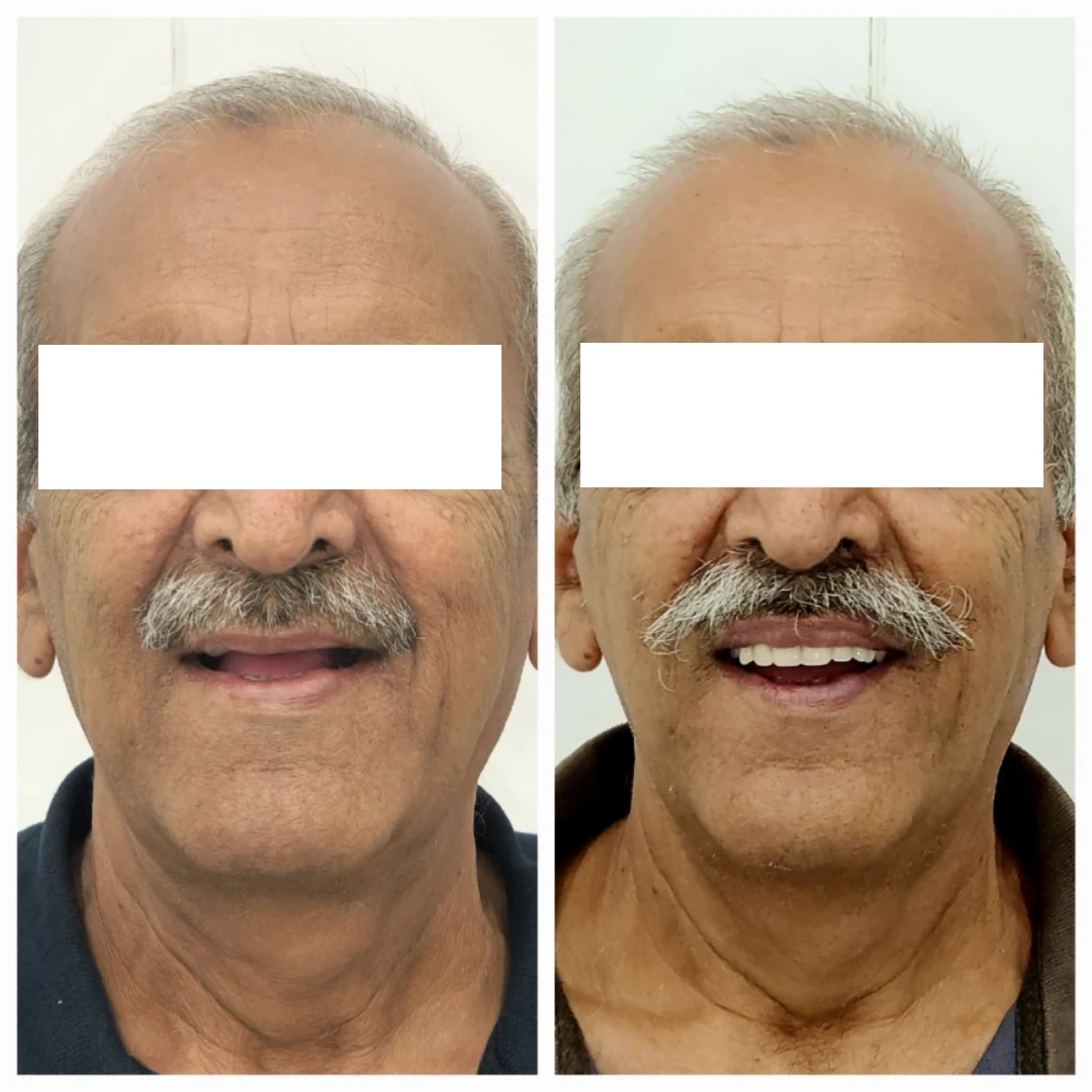 before after case 2