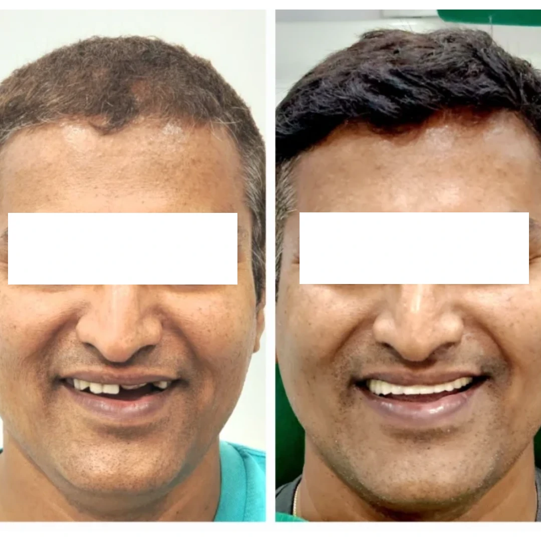 before after case 4